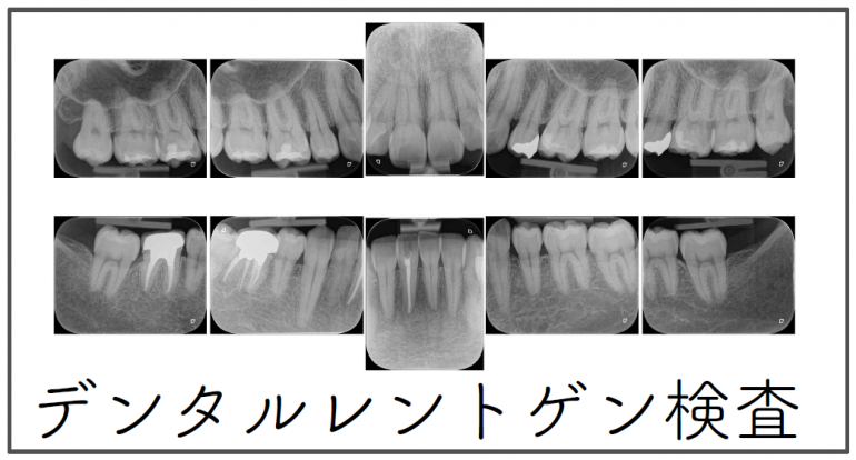 10枚法レントゲン