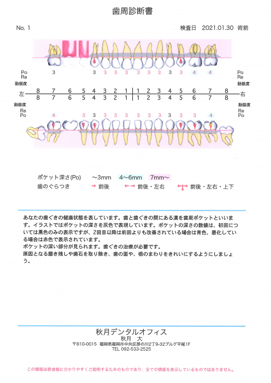 歯茎の検査結果