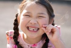 永久歯がまだなのに乳歯を抜く必要がある？成長と歯の深い関わり