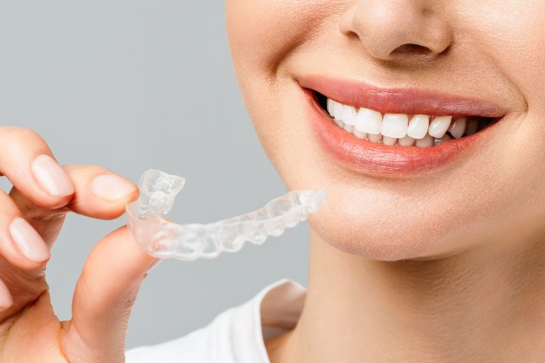 ホームホワイトニング