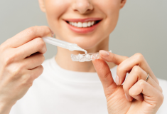 ホワイトニング開始